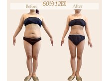 マクイエステティック 表参道店/30代ビフォーアフター