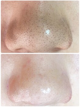 プリエ(Prier)/◇メンズフェイシャル◇ 