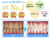 ホワイトニングカフェ 藤が丘店(WhiteningCafe)