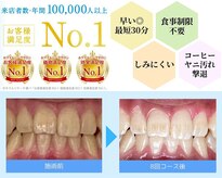 ホワイトニングカフェ 藤が丘店(WhiteningCafe)