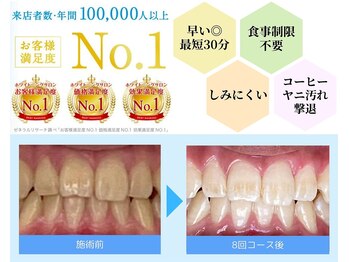 ホワイトニングカフェ 藤が丘店(WhiteningCafe)