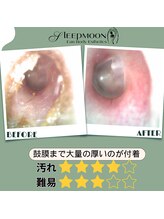 スリープムーン(Sleep MOON)/