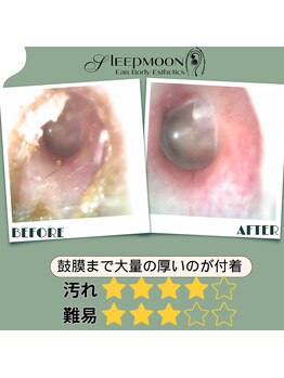 スリープムーン(Sleep MOON)/