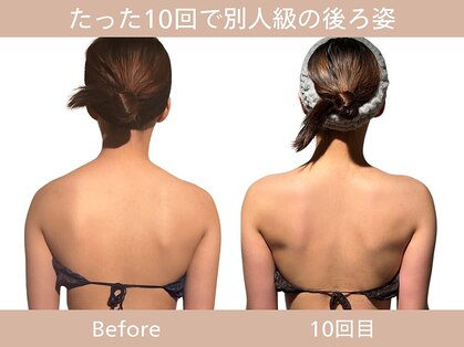 小顔フェイスラボ 神戸元町店(小顔 Face Labo.)の写真