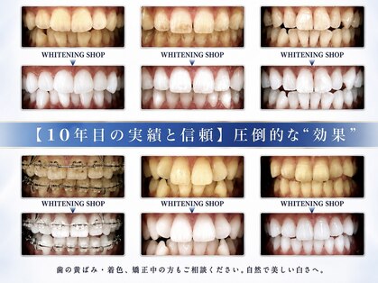 ホワイトニングショップ 福岡香椎店の写真