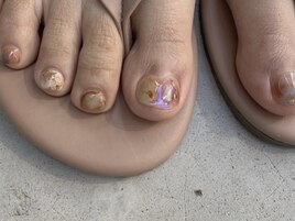 FOOT blancher design