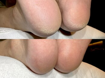 ラウン Nail salon Roun/フットケア