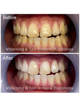 ハピネス 岡山店(Happiness)/43分