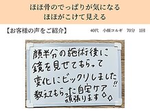 ペルク(perk)/ほほ骨のでっぱりが気になる