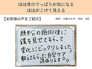 ペルク(perk)/ほほ骨のでっぱりが気になる