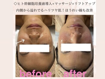 カラン(Calin)/30代後半お客様☆