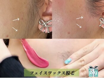 アンドナイン(AND NINE)の写真/《美肌★フェイシャルワックス》毛穴引き締め&鎮静生プラセンタパック付きで美肌ケアも同時に叶う