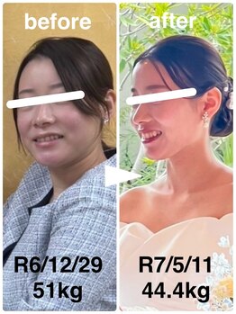 ハッチー(Hacchi)/【20代】ブライダル痩身！