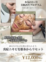 アトリエリュバン 梅田店(atelier Ruban) 炎症ニキビ 根本改善