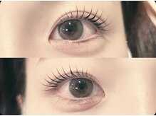 アイヴィー(ivy)/ラッシュリフト