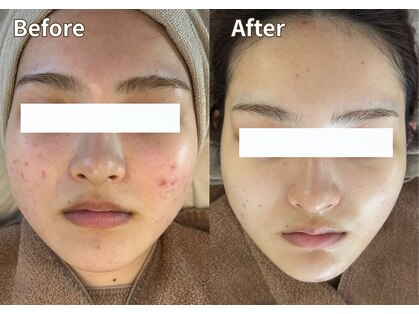 プティ 横浜店(Petit)の写真