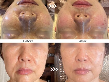 サロン アイプラス(salon i plus)の写真