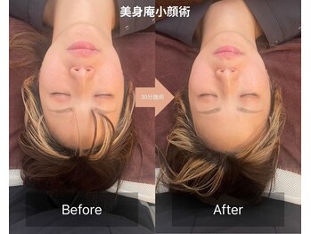 美身庵(Bishinan)の写真/【匠の本格小顔整体・黄金比★】顔の小ささはもちろん、左右差・顔立ちまでもあなたの理想に近づけます！！