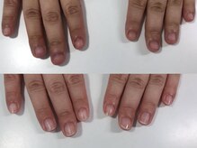 エスネイル(S-nail)/
