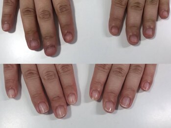 エスネイル(S-nail)/