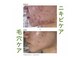 メアリリー(Mearily)の写真/鏡を見て落ち込む時間をゼロに！酵素/乳酸菌/ハーブの力で自分史上最高のうるツヤ素肌を手に入れませんか？