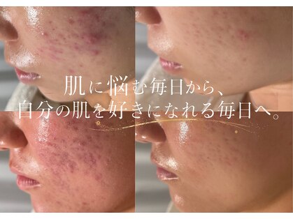 ルミライズ(lumirise)の写真