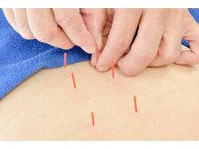 サロン ド ハリッシュ(Salon de HARISH)/鍼灸コースは肩こり腰痛にも◎