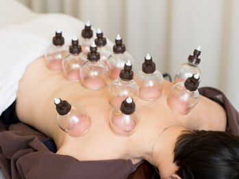 溝口鍼灸整骨院/吸い玉(カッピング)施術