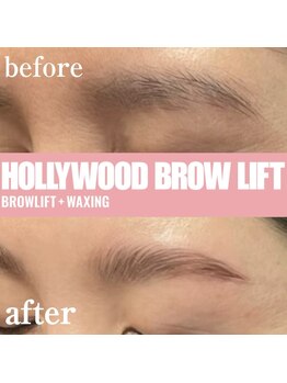 ブリリアント(brilliant)/ハリウッドブロウリフト