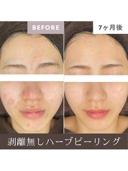 サードプレイス(3rd Place)/2階：エステ症例