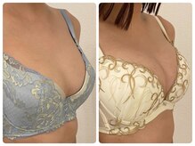 モナンジュ(ramonange)/バストアップ　before after