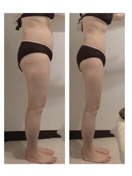 サロン リーナ 北千住店(Salon Lena)/根本改善痩身コース