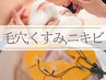 【毛穴/くすみ/ニキビケア】徹底改善！特許取得MC2X×金イオンピーリング60分