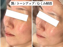 ブレリアントサロン 池袋店(brillant salon)/【30代女性】毛穴洗浄