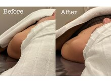 美容整体 レナトゥス 武庫之荘(Renatus)/フェイシャルだけど巻き肩改善