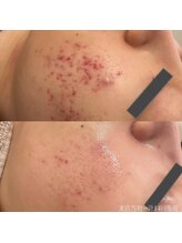 エクラ(eclat)/クリスティーナ