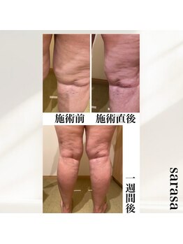 ナチュラル ビューティー スタイル さらさ(Natural Beauty Style)/さらさ血流循環ケア