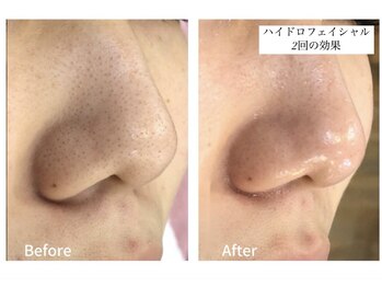 シリウス(Sirius)/3つの美容液で洗浄+潤いを