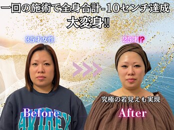 ミーアキャット 福岡天神(MEERKAT)/全身合計-10センチ達成