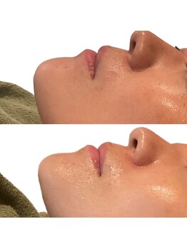 リムビューティー 自由が丘(RymBeauty)の写真/韓国肌管理｜透明感とツヤを引き出し、水光肌へ導く肌ケア