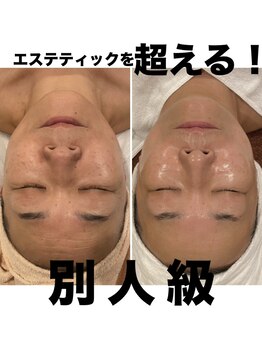 トータルエステティック ジョワイユ(JOYEUX)の写真/始めた人から変わり始める！50代から輝く、老け顔疲れ顔→ハリつや若肌へ◎