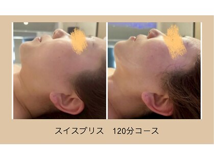 リシア(RECIA)の写真
