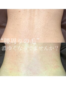 ジョエルワックス 沖縄那覇店(JOELLE WAX)/背中、腰周りの毛、、、