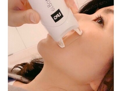 ココラの写真