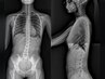 【反り腰・腰痛】1度で効果を実感！全身の不調を解消しながら痛みを改善