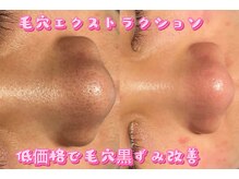 ビューティーザイオン(Beauty zion)