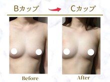 Ms.やまとなでしこ 明石店/ビフォーアフター