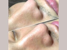 セリジェ 青山(Cerisier)/毎月のお手入れに通う男性も☆