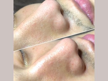 セリジェ 青山(Cerisier)/毎月のお手入れに通う男性も☆