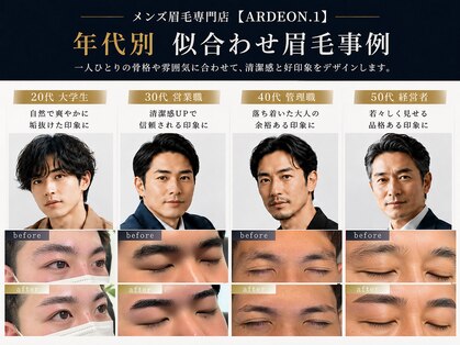 アルデオンワン(ARDEON.1)の写真